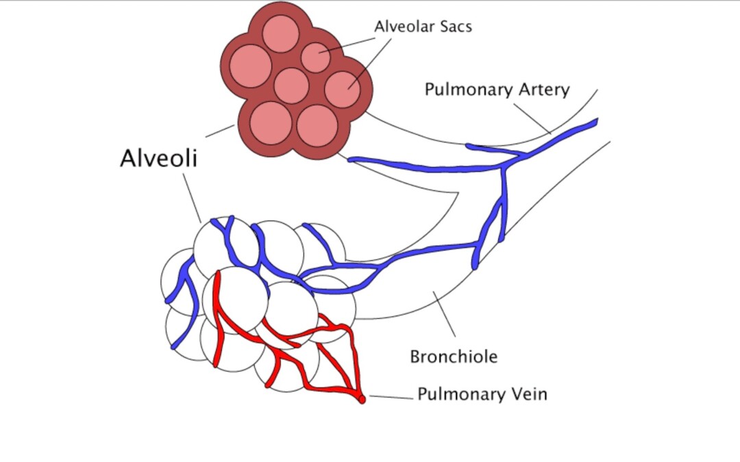 Covid-19, cellule alveolari di tipo II e surfactant  (articolo tradotto in italiano pubblicato sul Journal of Medical – Clinical Research & Reviews)